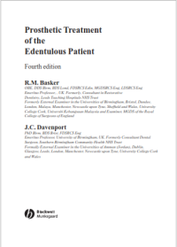 Prosthetic Treatment of the Eduntulous Patient