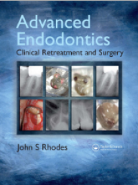 Advanced Endodontics; Clinical Retreatment and Surgery