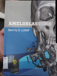 Ameloblastoma