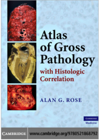Atlas of Gross Pathology with Histologic Correlation
