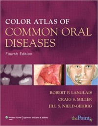 Color Atlas Of Common Oral Diseases