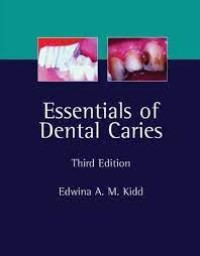 Essentials of Dental Caries : Third Edition