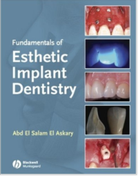 Fundamentals of Esthetic Implant Dentistry