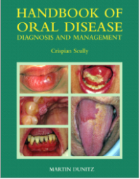 Hanbook Of Oral Disease Diagnosis and Management