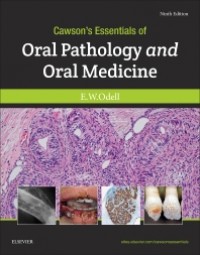 Cawson's Essential of Oral Pathology And Oral Medicine