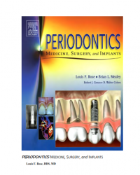 Periodontics Medicine, Surgery and Implants
