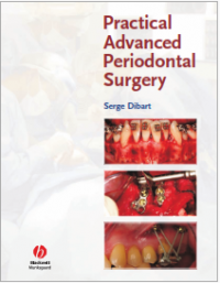 Practical Advanced Periodontal Surgery