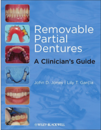Removable Partial Dentures: A Clinician's Guide