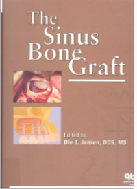 The Sinus Bone Graft